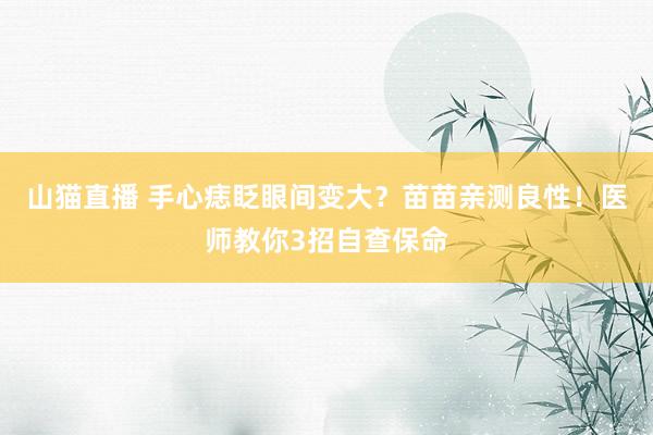 山猫直播 手心痣眨眼间变大?苗苗亲测良性!医师教你3招自查保命